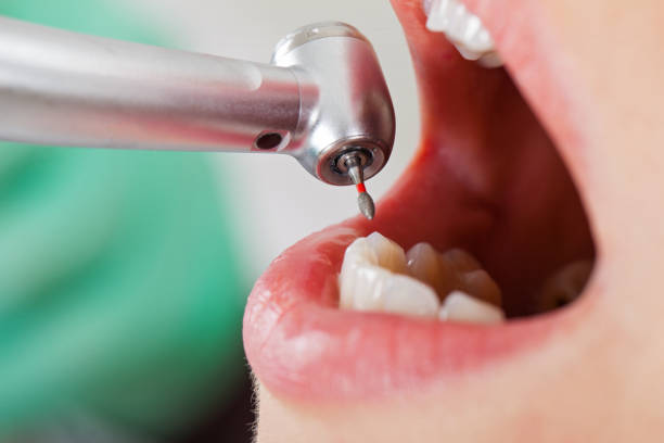 Best Emergency Gum Pain Relief  in Westke, LA